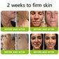 Regain youthful skin now!💫 BOTOX VITA A RETINOL SHOT Wrinkle-smoothing firming cream