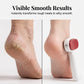 🎁LIMITED SALE BUY 2 GET 1 FREE!!🔥Double-Sided Foot Scraper for Callus Removal